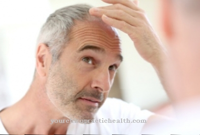 Home remedies for hair loss