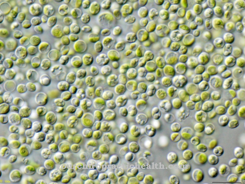 Chlorella