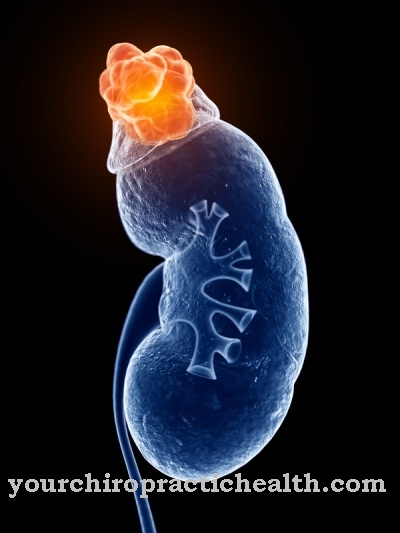 Achard-Thiers Syndrome