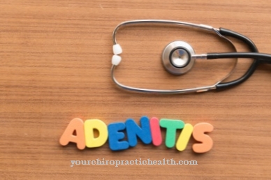 Adenitis