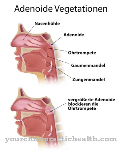 Adenoids