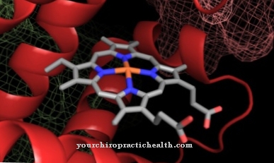 Acute intermittent porphyria