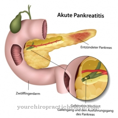 Pankreatitis akut