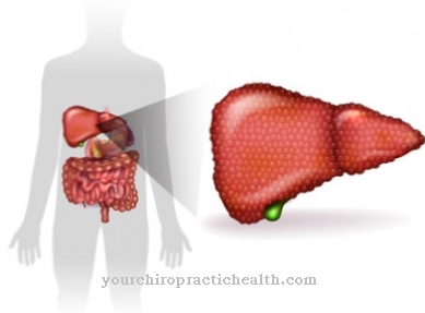 Alcoholic liver disease