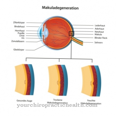 Degeneração macular relacionada à idade