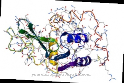 amyloidosis