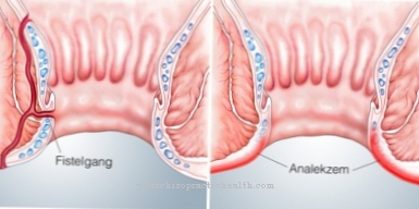 Anal eczema