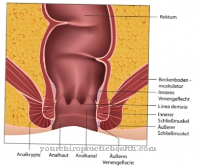 Anal prolapse