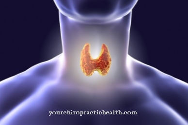 Congenital hypothyroidism