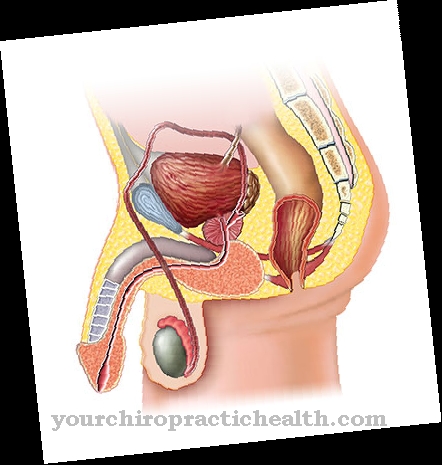 Congenital penile curvature