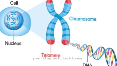 Angelman Syndrome