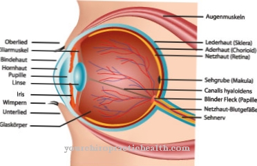 Anophthalmos