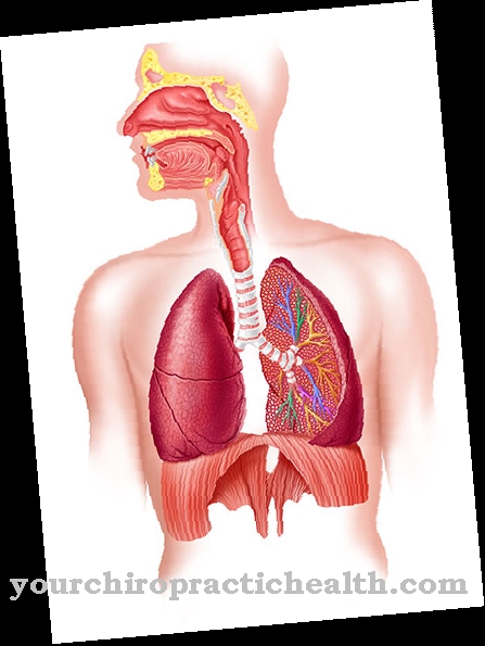 Anthracosis