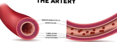 Aortic dissection