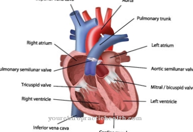 Coarctation of the aorta