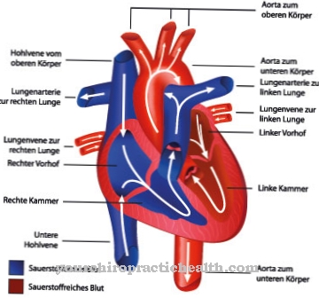 Aorto-pulmonary window