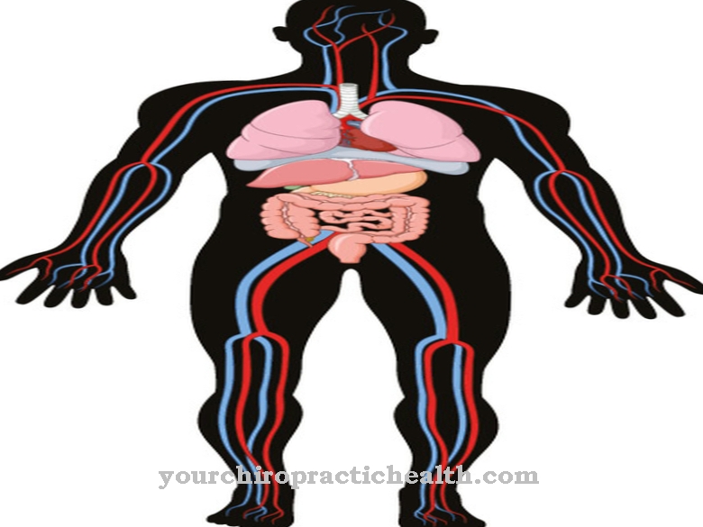 Superior mesenteric artery syndrome