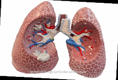 Aspiration pneumonia