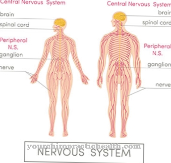 Astereognosia