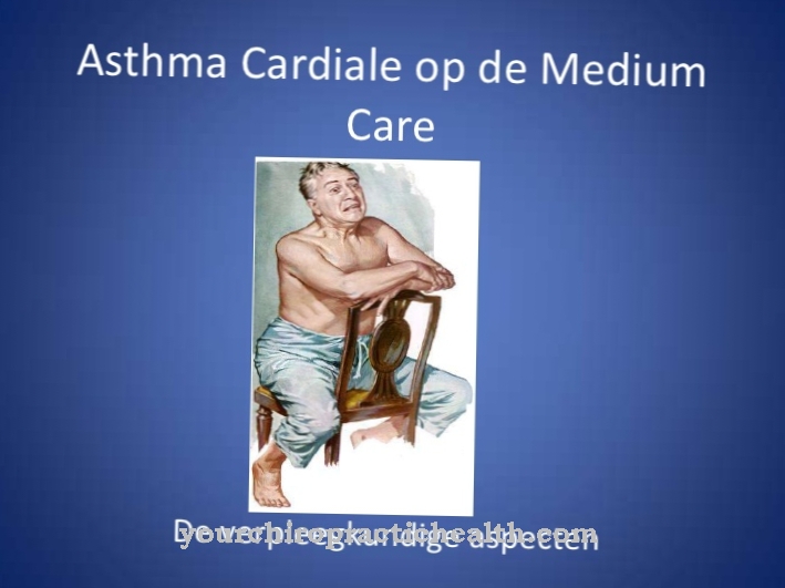 Cardiac asthma