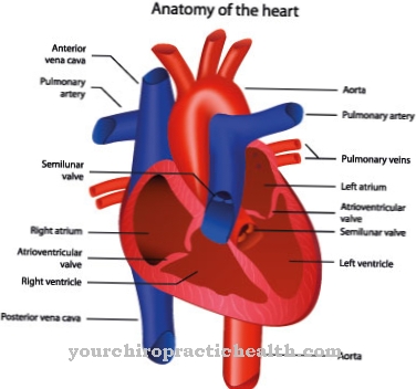 Defect septal atrioventricular