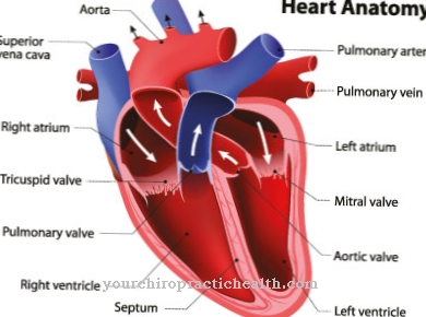 Atriaal septumdefect