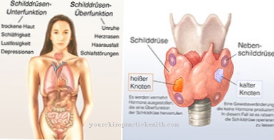 Autoimmune thyroid disease