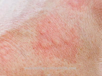 Bath dermatitis