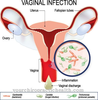 Vaginose bacteriana