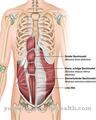 Abdominal muscle strain