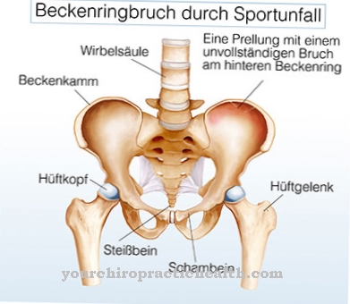 Pelvic fracture