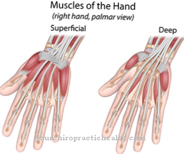 Eldeki fleksör tendon yaralanmaları