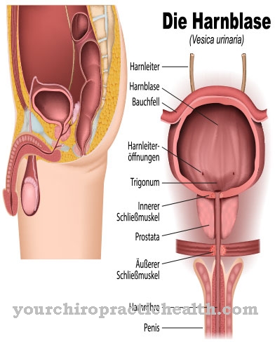 Bladder exstrophy