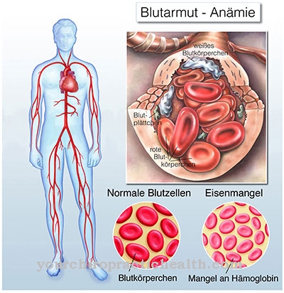 Keracunan plumbum