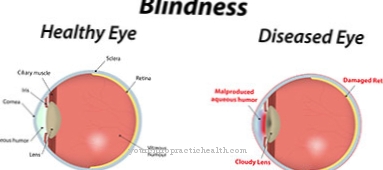 blindness