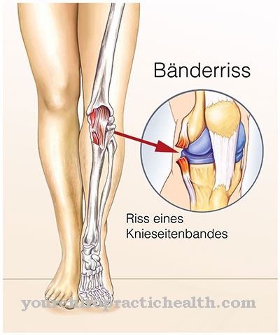 Rivet ligament