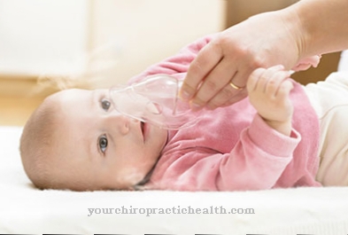 Bronchiolitis