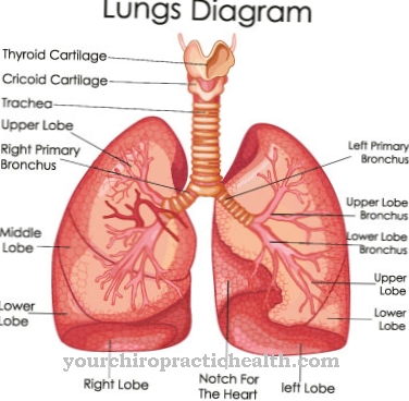 Bronhopulmonalna displazija