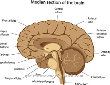 Síndrome del cerebro bulbar