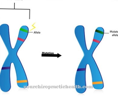 CHARGE syndrome