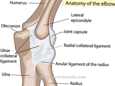 Chassaignac palsy