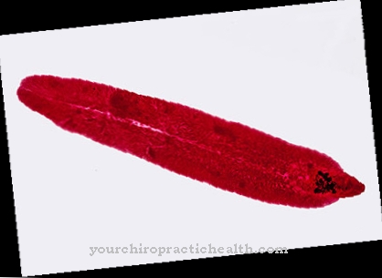 Trematode epatico cinese (clonorchiasi)