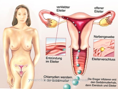 Chlamydia (chlamydial infection)