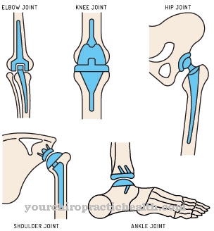 Chondropathy