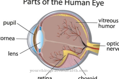 chorioretinitis