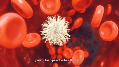 Chronic lymphocytic leukemia