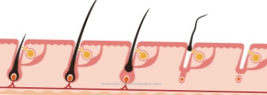 Clouston Syndrome