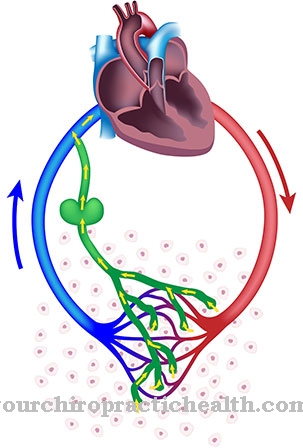 Crigler-Najjar Syndrome