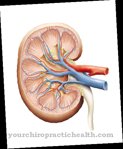 Cystinosis