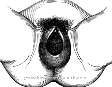 Perineal tear